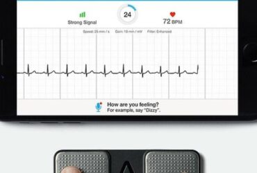 تقنية-جديدة-لإجراء-“تخطيط-القلب”-عبر-الهاتف-النقال